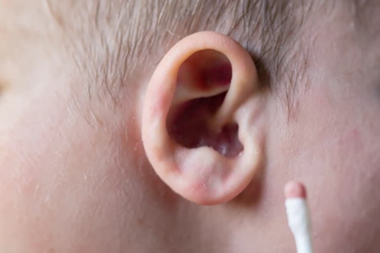 Um close-up de um ouvido de bebê com um cotonete ao lado, sugerindo a delicadeza da área.